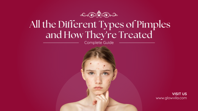 Teenage girl with visible facial acne, complete guide to different types of pimples and treatment