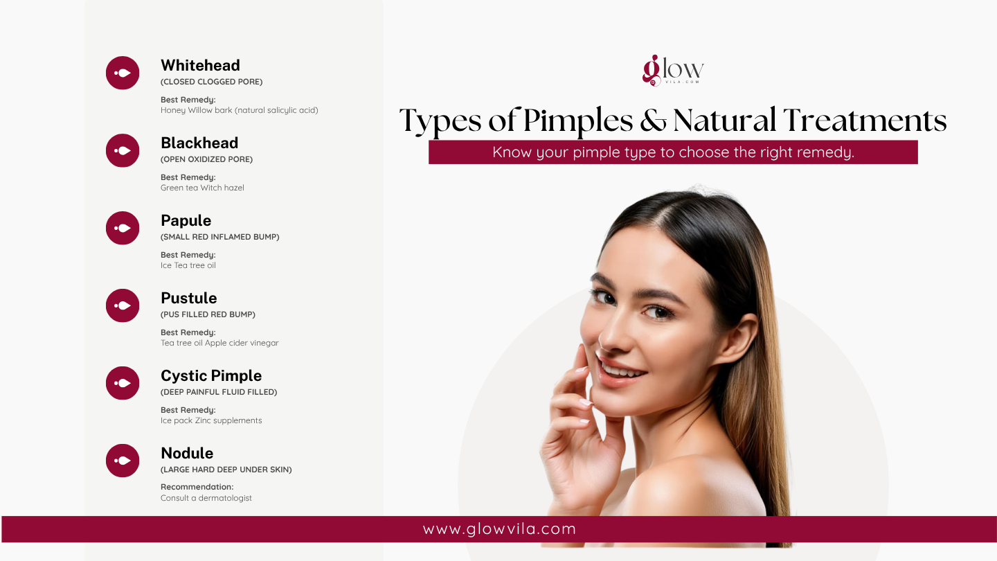 Infographic of 6 pimple types — whitehead, blackhead, papule, pustule, cystic, nodule — with their best natural remedies