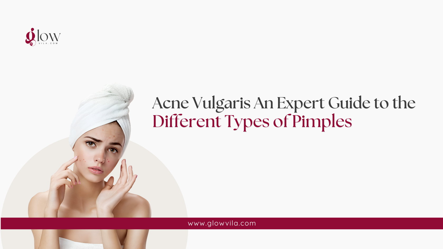 Woman examining acne on her cheek, expert guide to acne vulgaris and pimple types