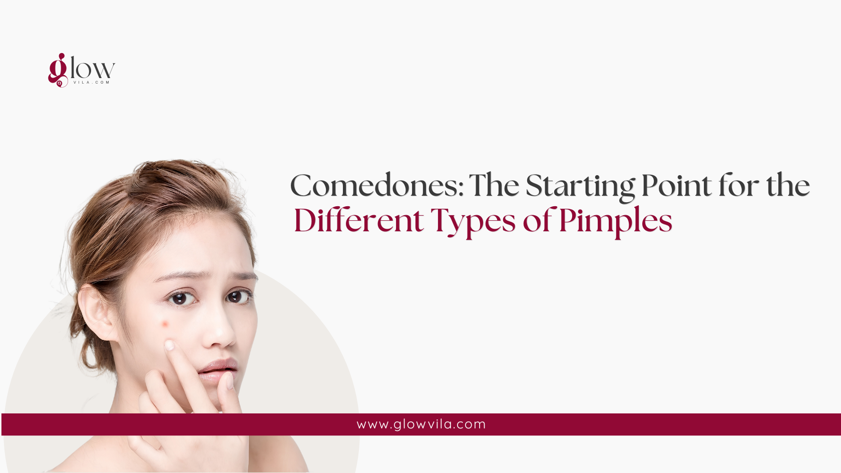 Woman touching a comedone on her cheek, illustrating comedones as the starting point for pimples
