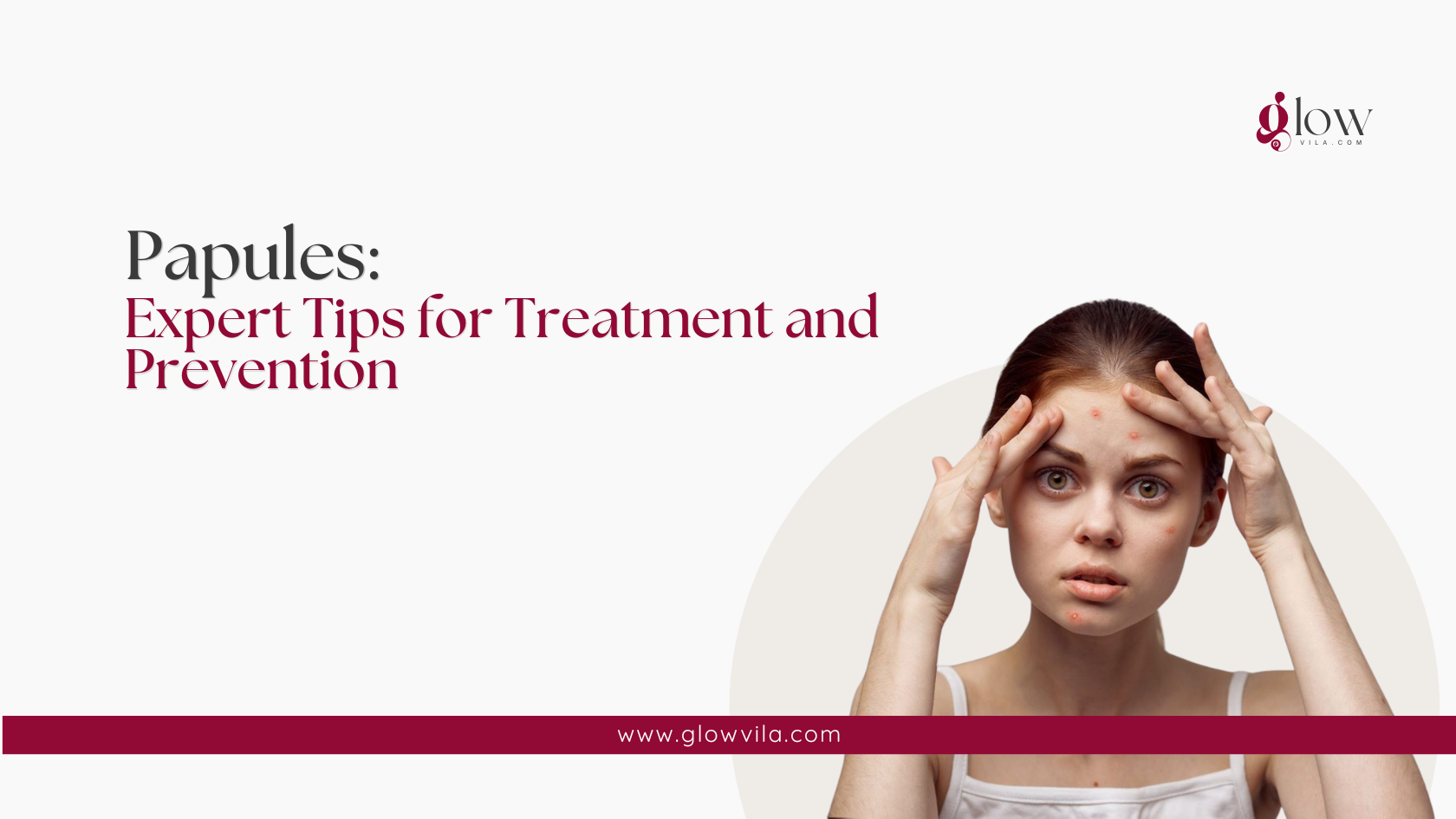 Woman with visible papules on her forehead, expert tips for papule treatment and prevention