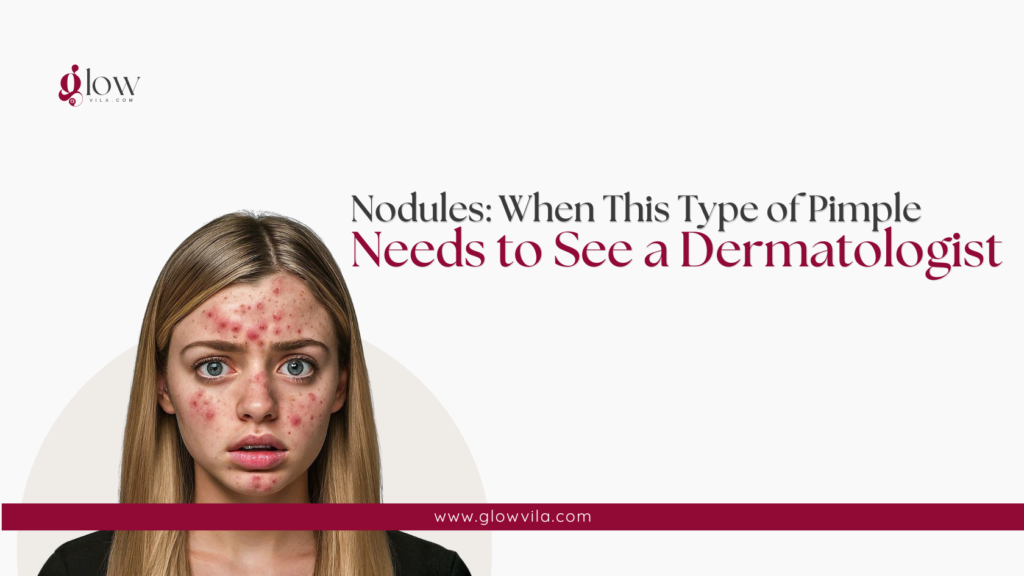 Woman with nodular acne across her forehead, signaling when to see a dermatologist