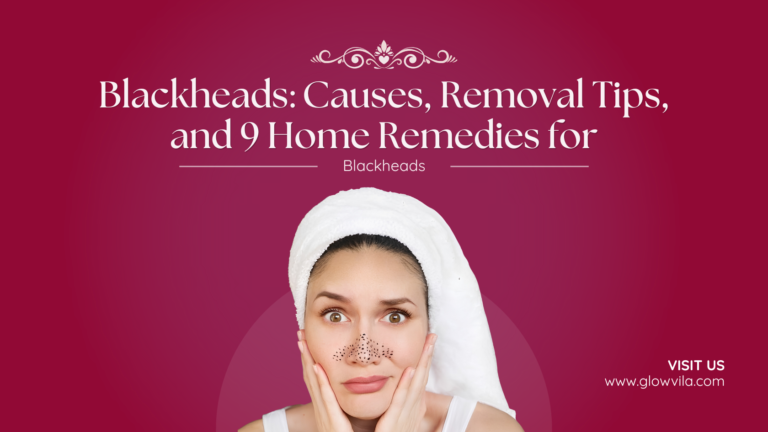 Woman with blackheads on her nose learning how to get rid of blackheads naturally