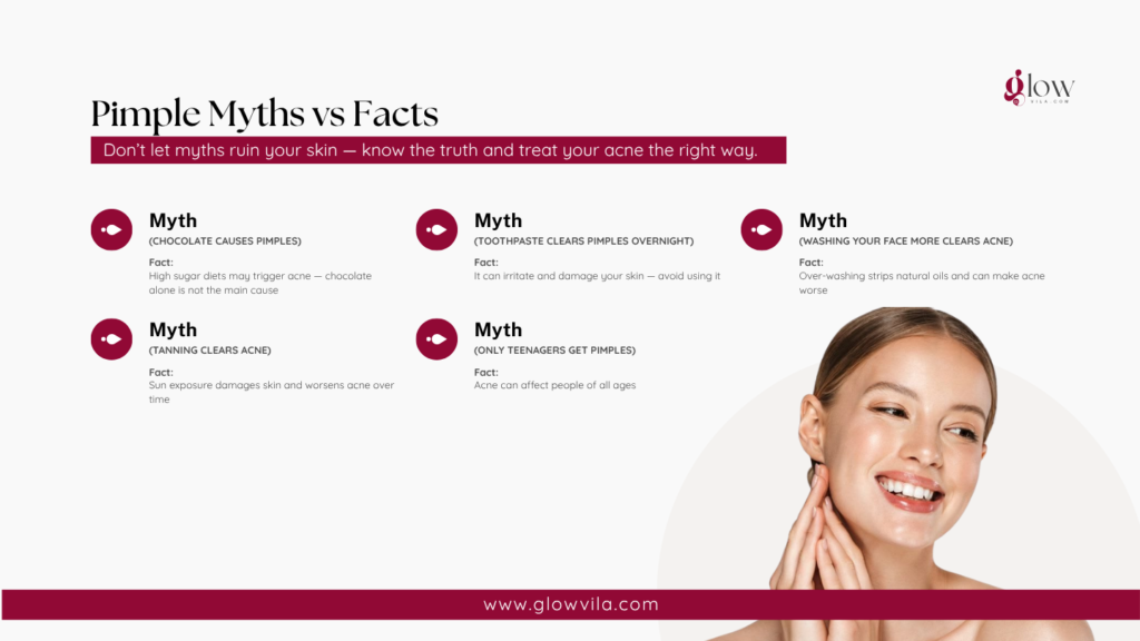 Infographic debunking 5 common pimple myths, including chocolate, toothpaste, and tanning