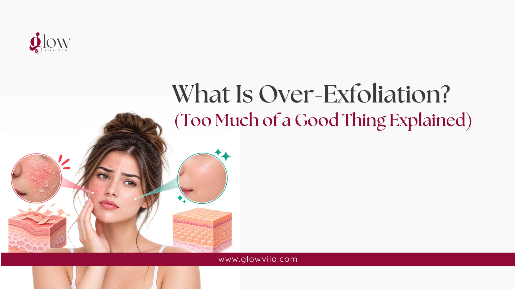 Split-face comparison of damaged versus healthy skin barrier illustrating what over-exfoliation is