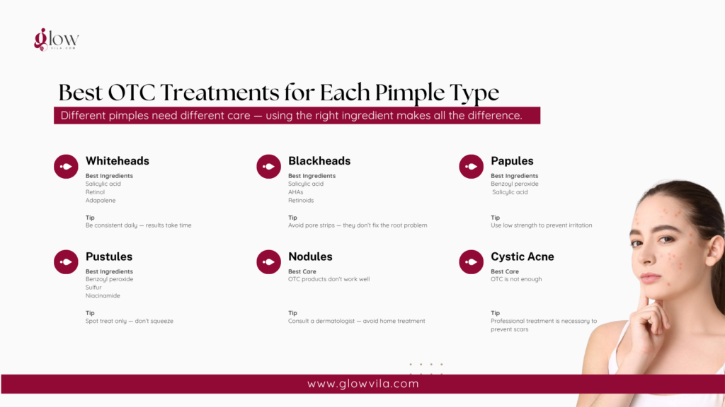 Infographic listing best OTC ingredients and tips for whiteheads, blackheads, papules, pustules, nodules, and cystic acne