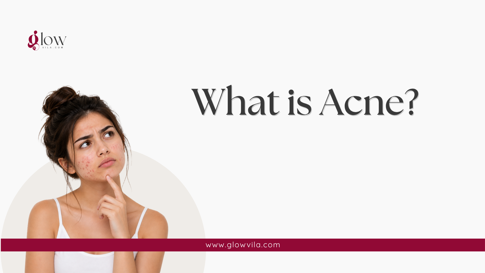 Woman with visible acne on her face illustrating what acne is