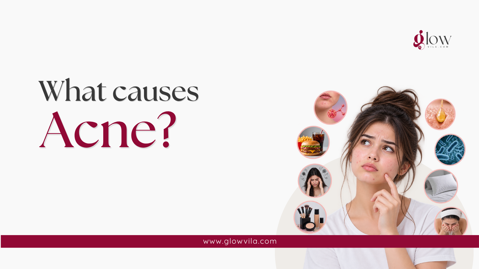 Woman surrounded by icons of acne causes: diet, bacteria, stress, hormones, dirty pillowcases, and makeup