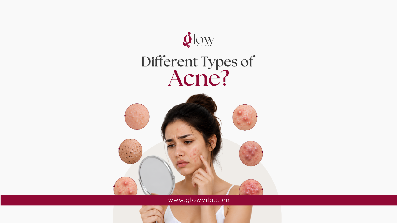 Woman examining her skin surrounded by close-up images of different acne types