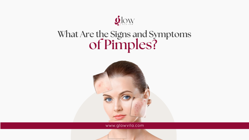 Close-up of inflamed pimples on the forehead and cheek showing common acne symptoms