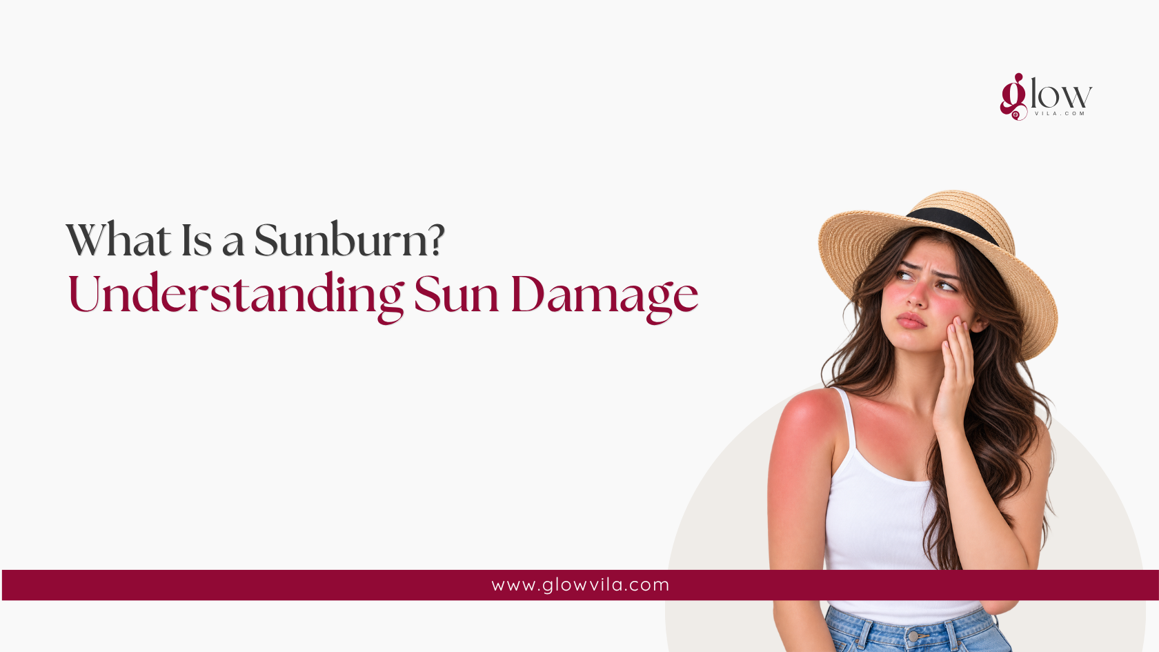 Woman with a visibly sunburned shoulder and cheek, understanding sun damage