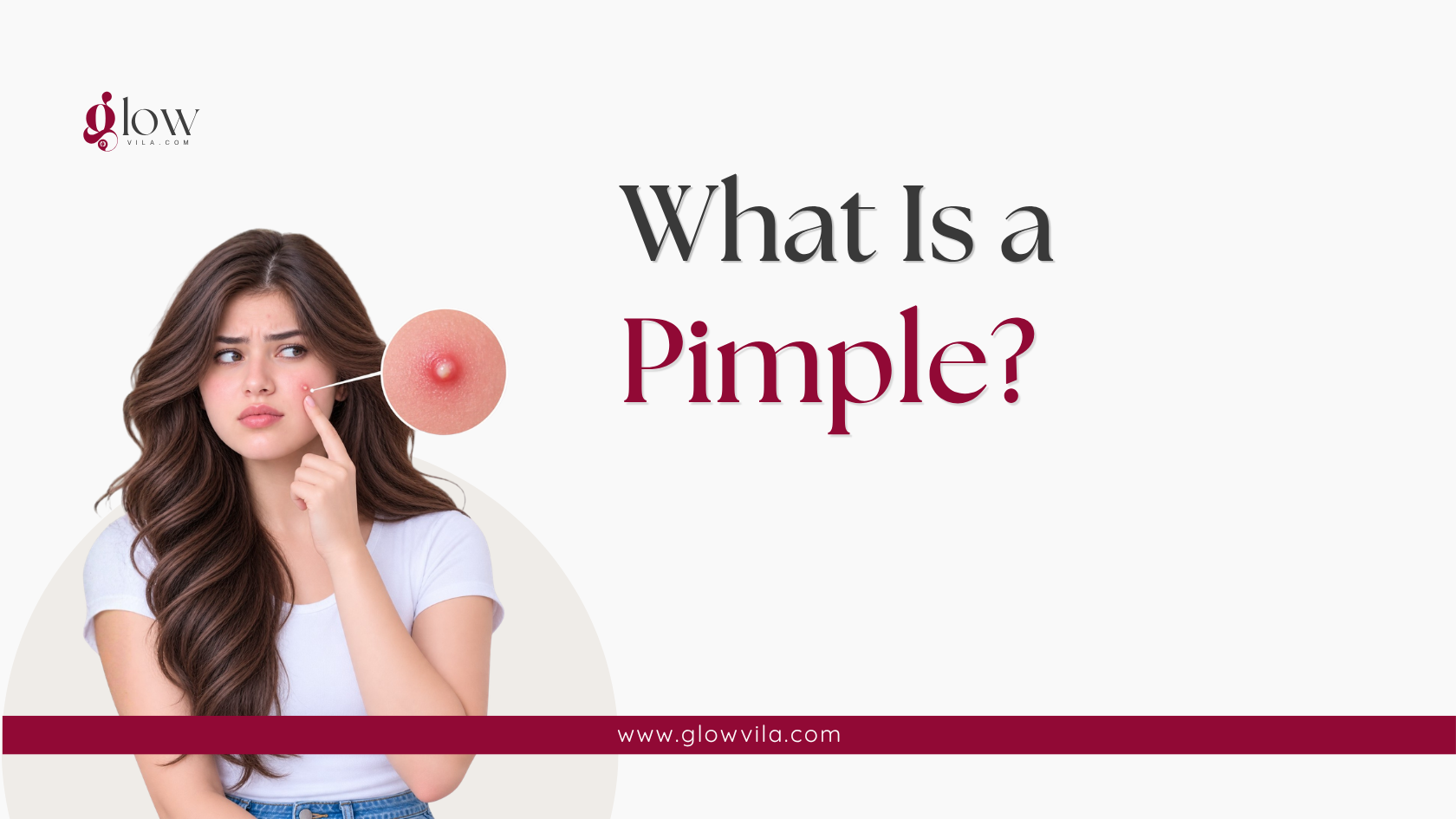 Close-up of a single pimple beside a woman touching her cheek, illustrating what a pimple is