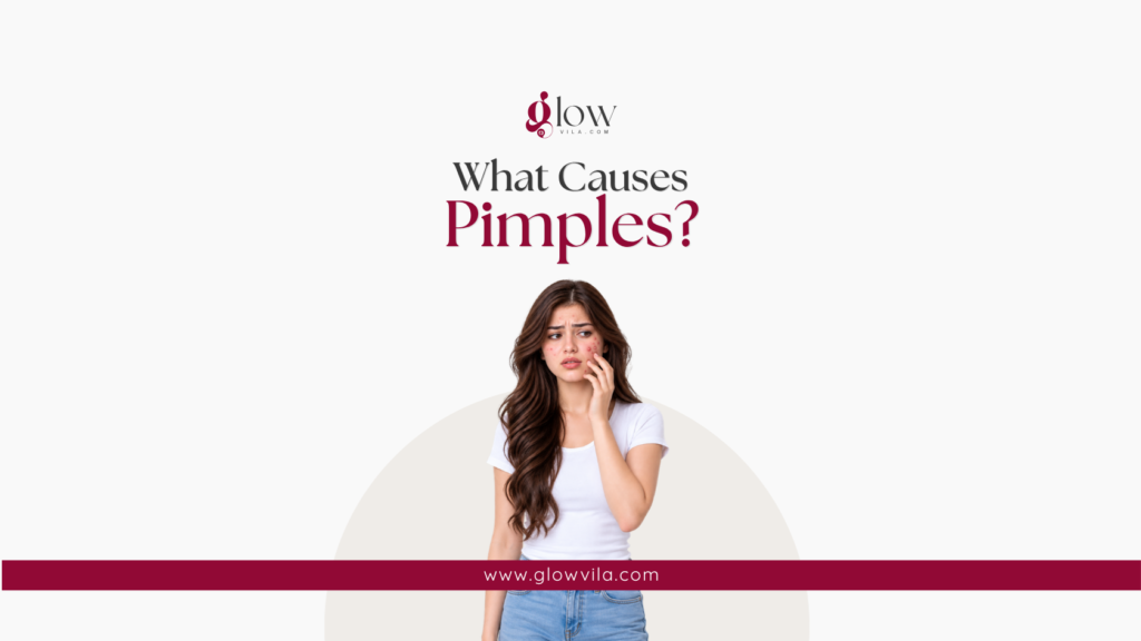 Woman with a few scattered pimples on her cheek illustrating what causes pimples