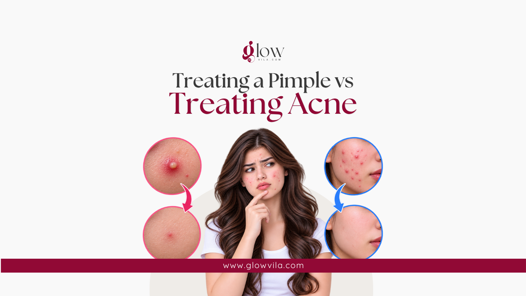 Before-and-after close-ups of a healed pimple and treated acne beside a thoughtful woman