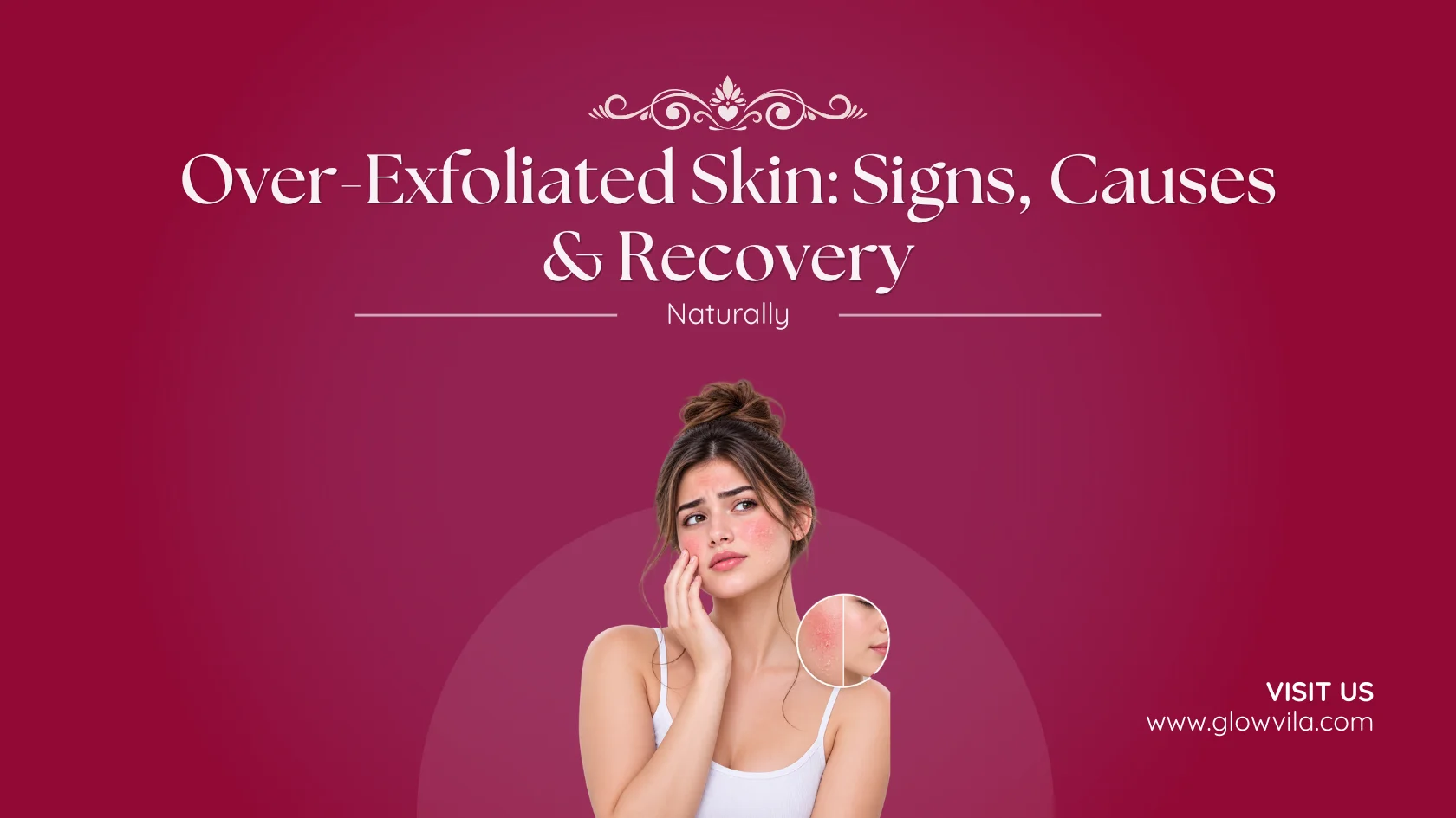 Woman with irritated, over-exfoliated skin touching her cheek, guide to signs, causes, and recovery